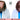 Causes of Hair Loss in Women & Treatment