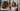 Non-Surgical Hair Restoration Near San Mateo & San Francisco