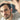 Top Male Pattern Hair Loss Treatments Bay Area