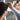 Trichotillomania Therapy: Manage Hair Pulling Disorder Effectively