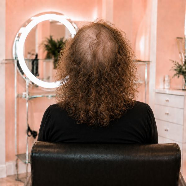Before — Full Crown Coverage