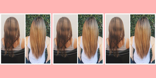 Salon Stories: The Silent Battle with Trichotillomania