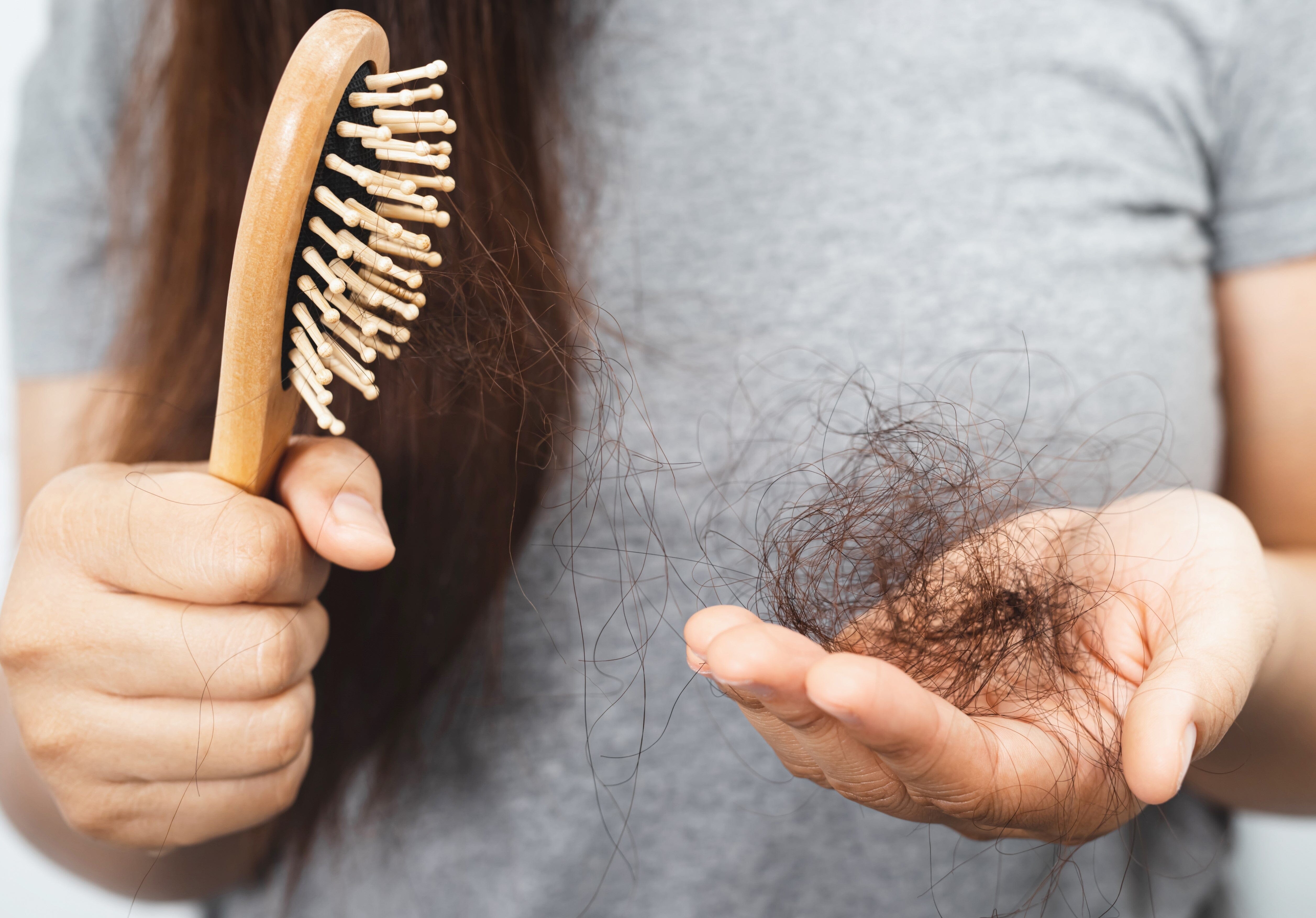 Female Pattern Baldness & Hair Loss