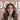 Hair Loss Solutions in San Mateo & San Francisco, CA