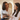 Top Female Hair Loss Remedies & Treatments for Baldness