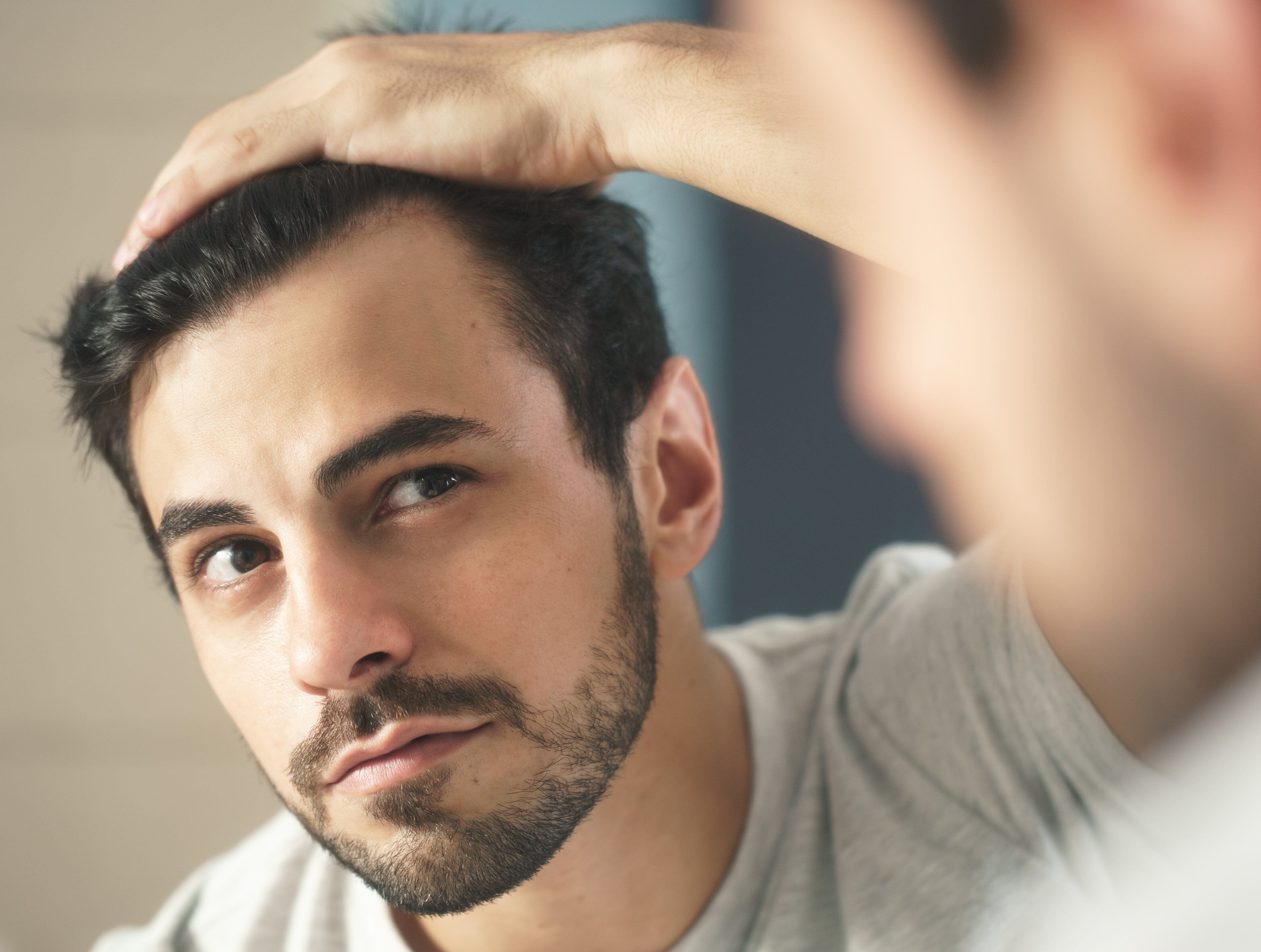 Top Male Pattern Hair Loss Treatments Bay Area
