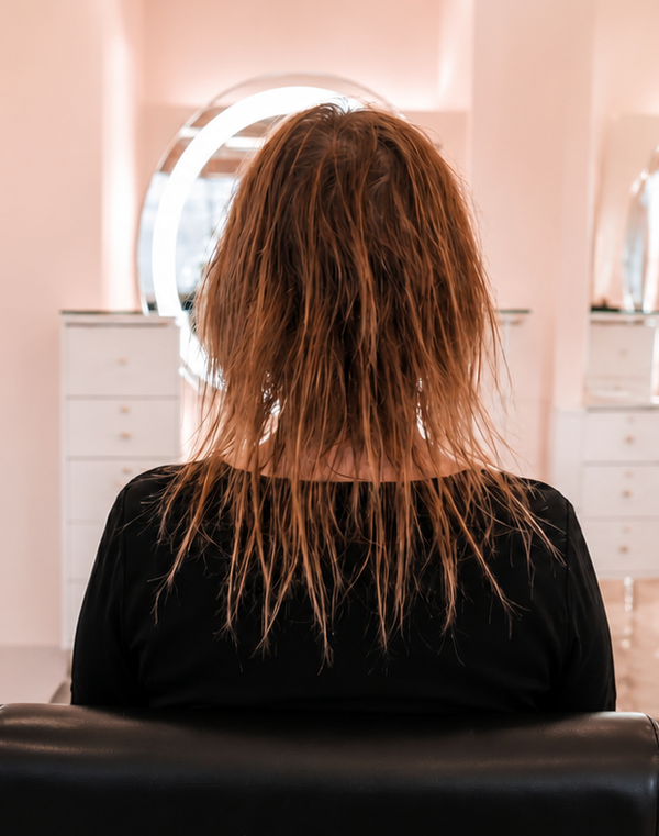 Before — Custom Hair Replacement